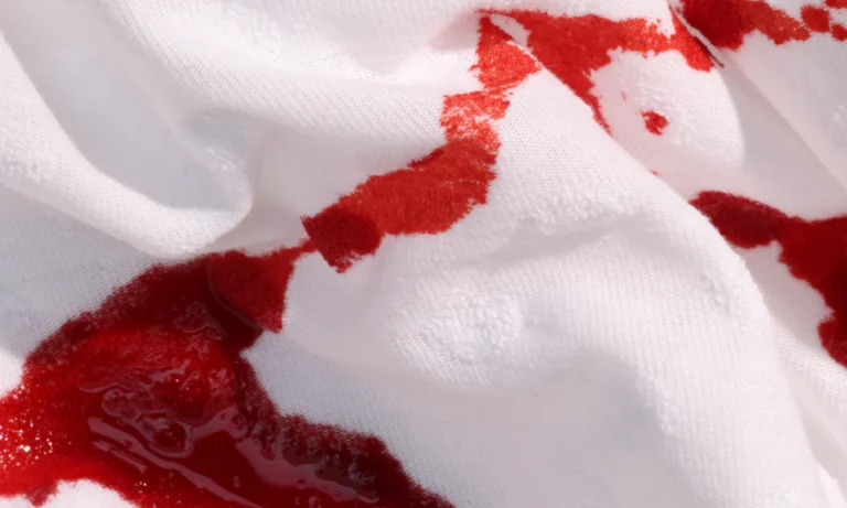 Blood or Organic Stains
